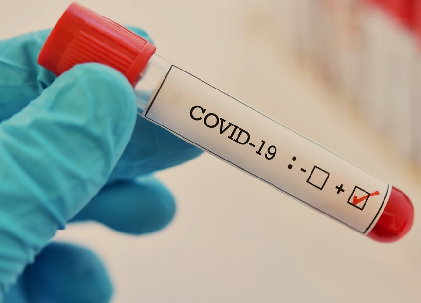 कैटलस एंजाइम से हो सकता है कोविड-19 का उपचार